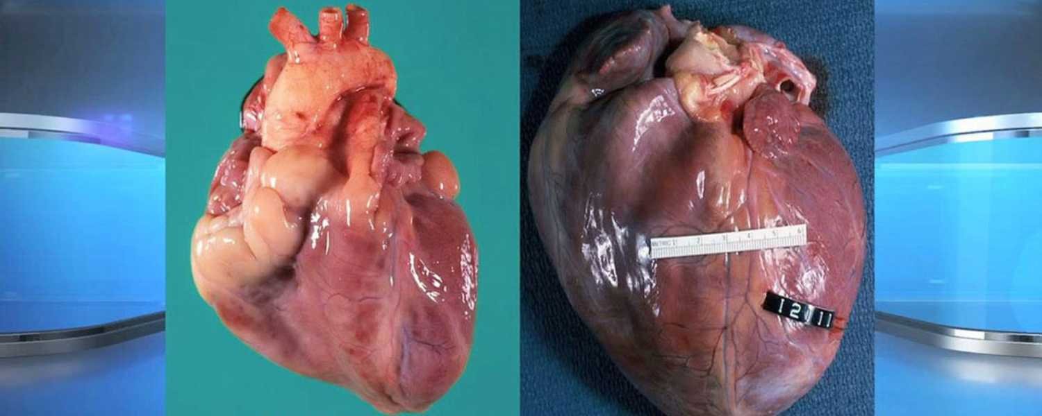 Illegal Drugs & Heart Damage